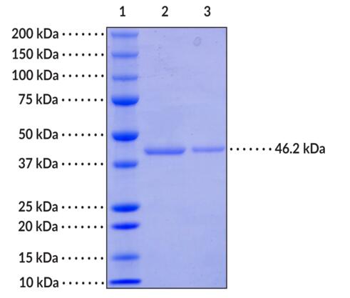 Lane 1: MW Standards<br />Lane 2: PAF-AH (4 μg)<br />Lane 3: PAF-AH (2 μg)